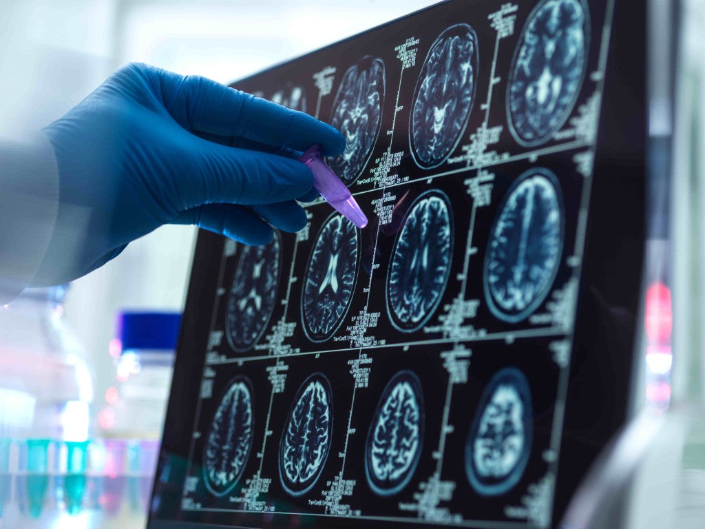 How the eCSeptionOL Formula Targets Neuroinflammation, Oxidative Stress, and Cognitive Decline